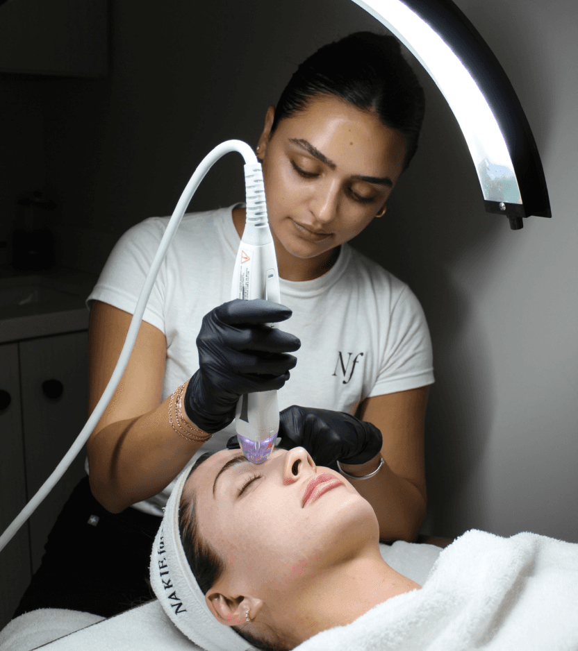 RF Microneedling